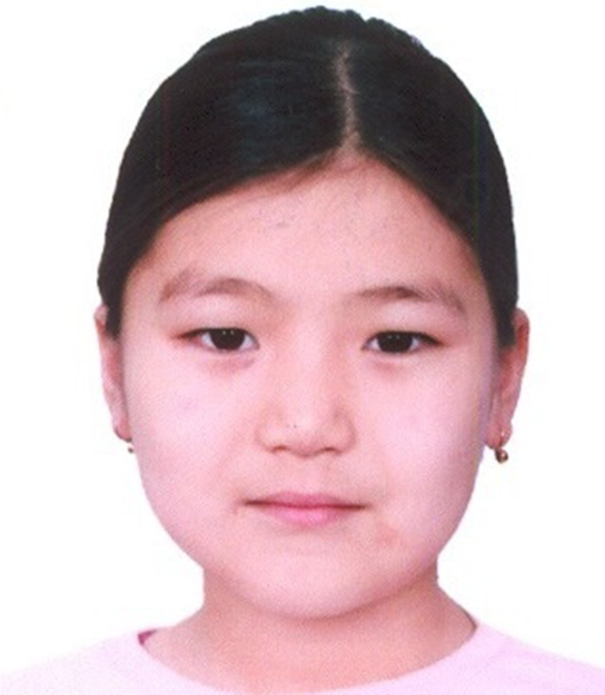 Picture of The orphan Jasmine - Kyrgyzstan - 4374479
