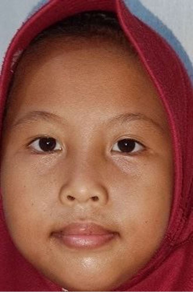 Picture of Orphan - Azmi - Indonesia - 073091